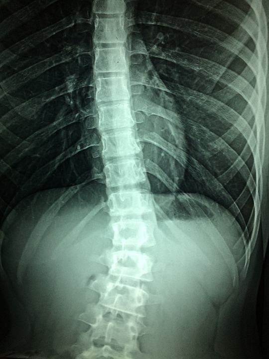 פריצת דרך. שיקום פגיעת עמוד שדרה בטיפול ייחודי. צילום: Pixabay Dr. Manuel González Reyes